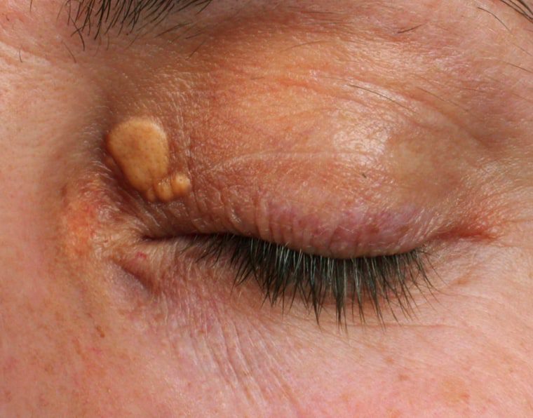 704a5b39d51130f6d3638287a5b3fd84